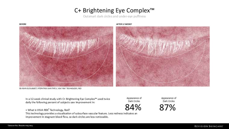 C+ Brightening Eye Complex™