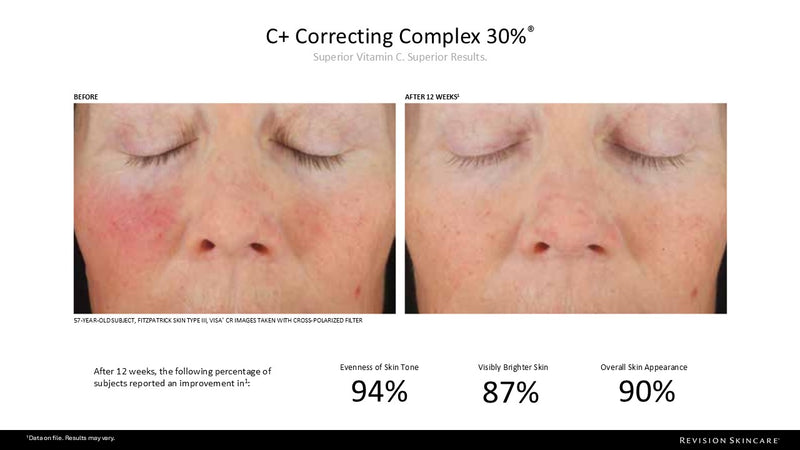 C+ Correcting Complex 30%™