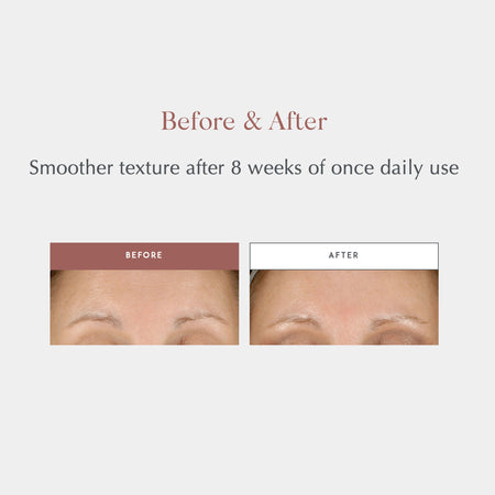 Exuviance® Daily Resurfacing Peel CA10