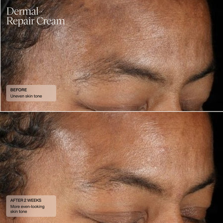 Senté Dermal Repair Cream