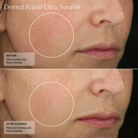 Senté Dermal Repair Ultra Nourish