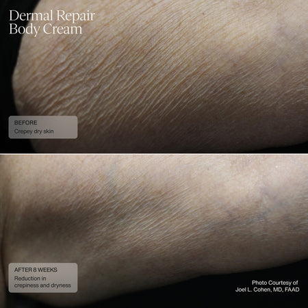 Dermal Repair Body Cream