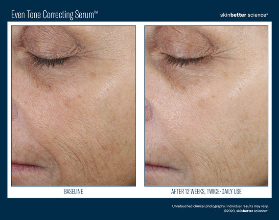 Even Tone Correcting Serum™