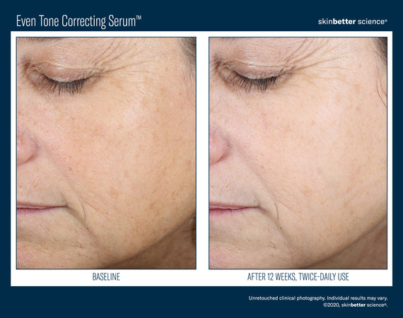 Even Tone Correcting Serum™