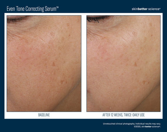 Even Tone Correcting Serum™