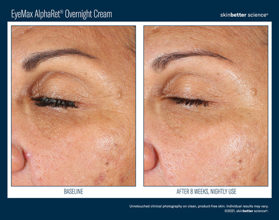 EyeMax™ AlphaRet® Overnight Cream