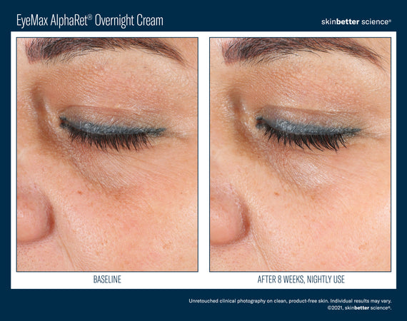 EyeMax™ AlphaRet® Overnight Cream