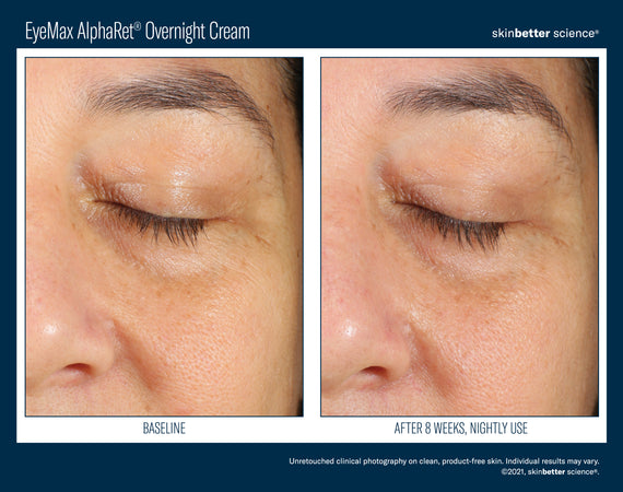 EyeMax™ AlphaRet® Overnight Cream