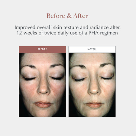 Exuviance® Overnight Transformation Complex