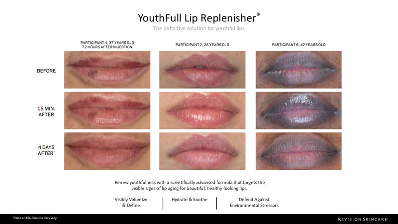 YouthFull Lip Replenisher™